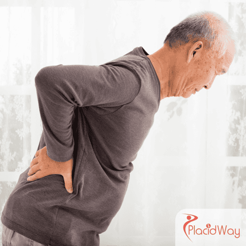 Stem Cell Therapy for Arthritis in Mexico: High-Quality Care for Arizona Tourists